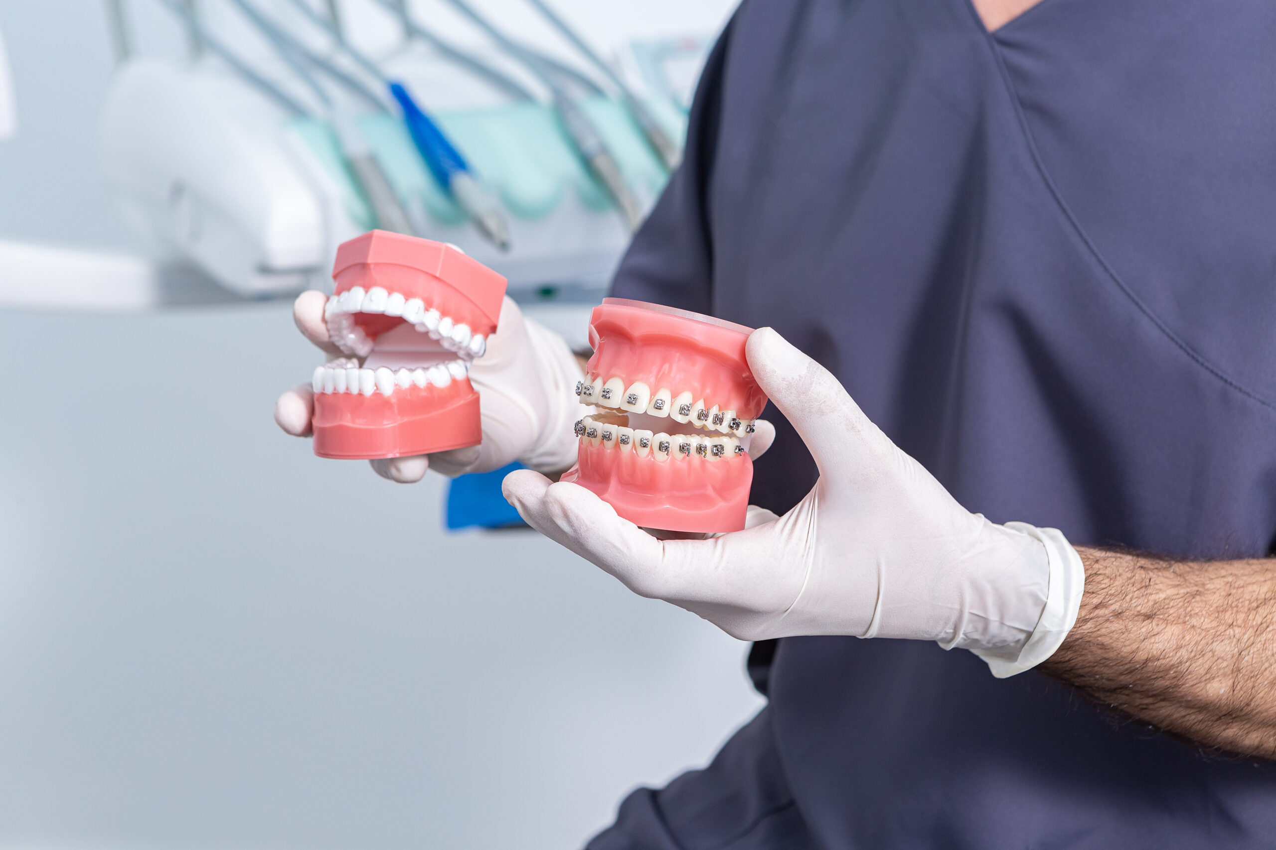 What is the difference between Invisalign and Braces?